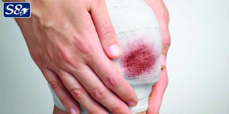 Mộng tai nạn đổ máu